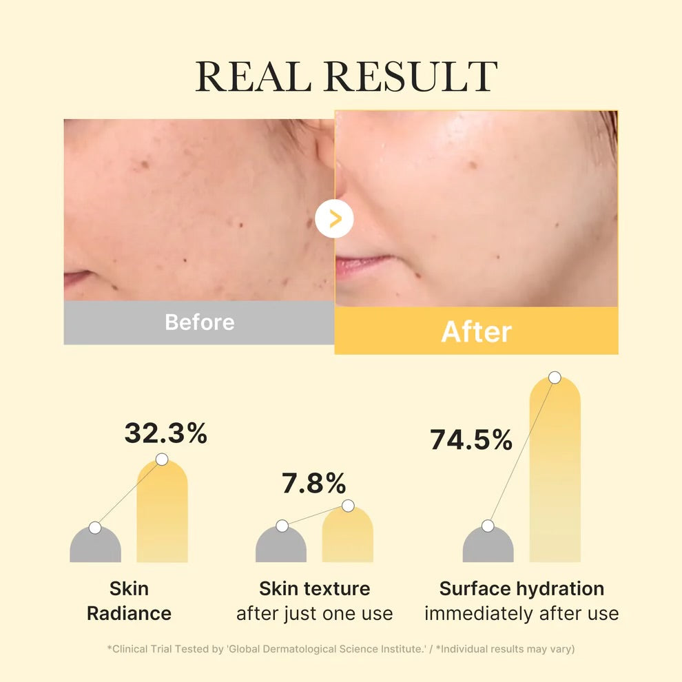 Kojic Acid Turmeric Brightening Gold Jelly Gel Mask