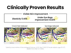 Seoul 1988 Eye Cream – Retinal Liposome 4% + Fermented Bean 30ml